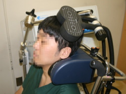 rTMS治療：東京慈恵会医科大学